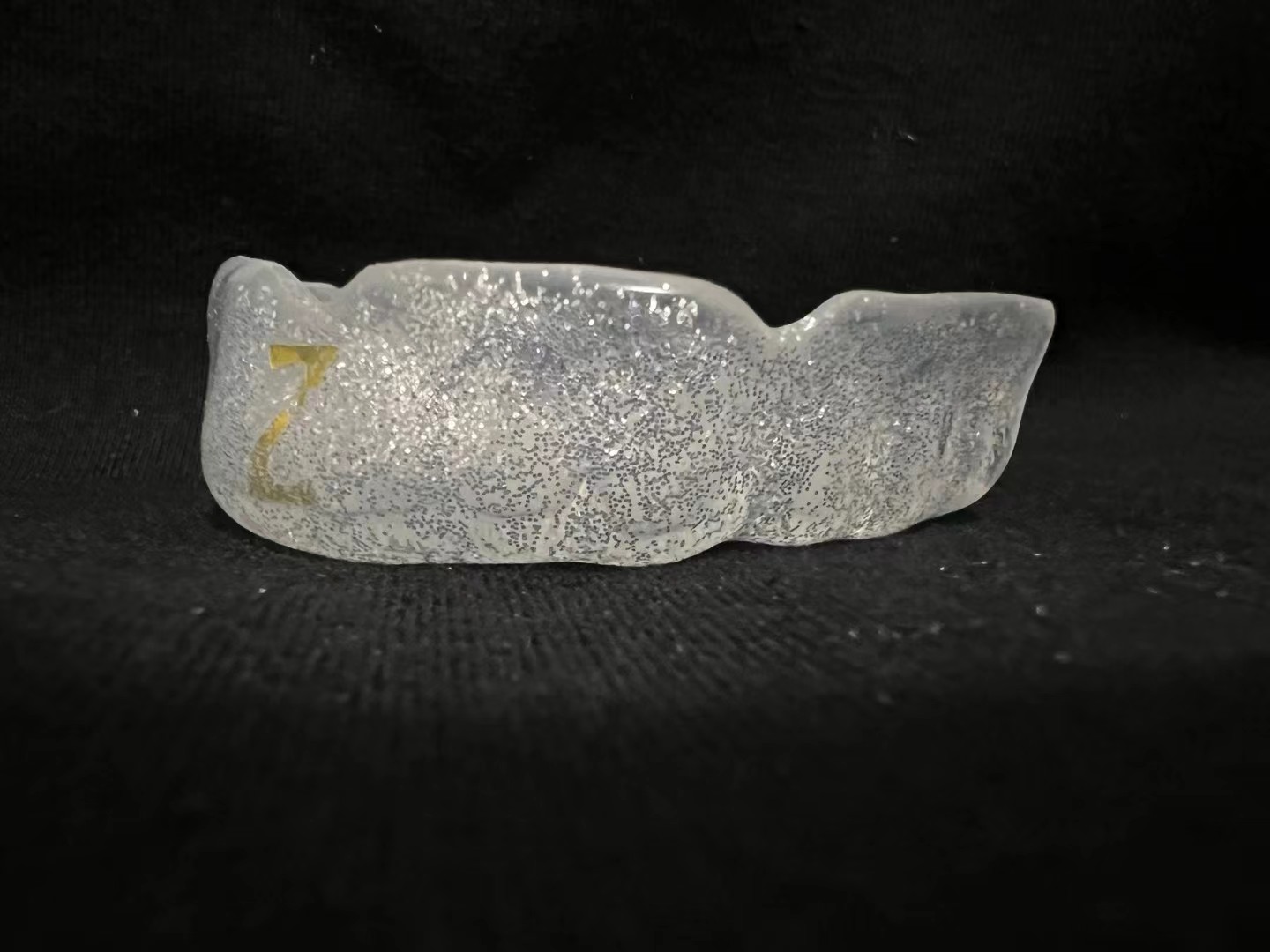 Customer 18 mouthguard view 1