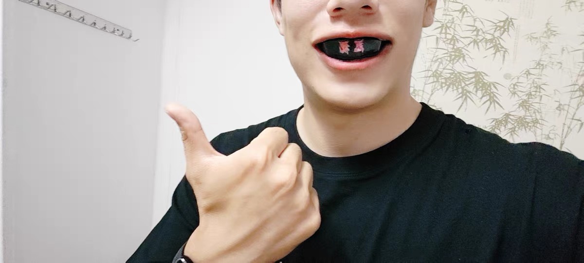 Customer 10 mouthguard view 2